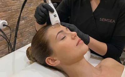 LPG Visage endermolift